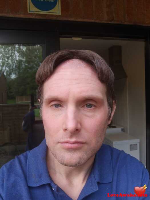 Acquiesce UK Man from Alderley Edge