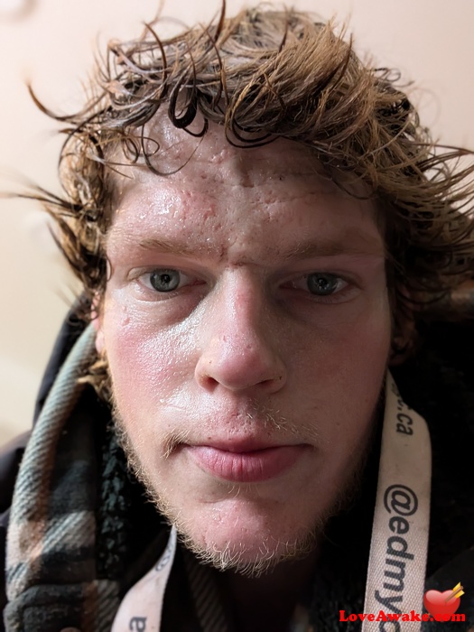 opbumm1 Canadian Man from Edmonton